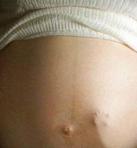 pregnant person